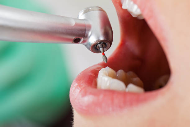 Best Tooth Infection Emergency Dentist  in Eunice, NM